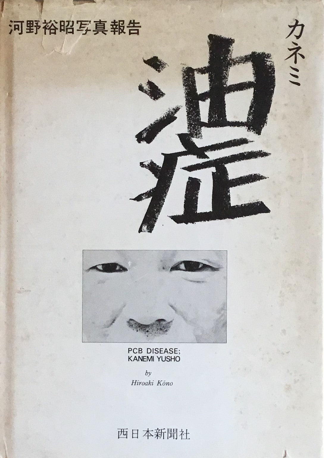 カネミ 油症 河野裕昭写真報告